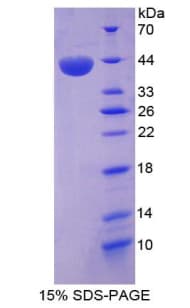 Rat LIPA / Lysosomal Acid Lipase Protein (Recombinant His-T7)
