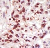 MAP3K8 / TPL2 Antibody (aa368-397)