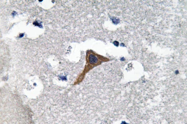 CTSH / Cathepsin H Antibody (aa156-205)