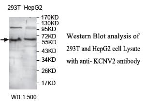 KCNV2 / Kv11.1 Antibody (aa12-154)