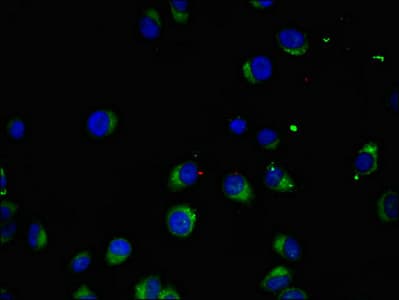 MAK Antibody