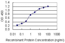 IHC-plus™ KCNJ5 / Kir3.4 / GIRK4 Antibody (clone 8D2)
