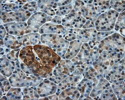 Monoclonal Mouse anti-Human PPP5C Antibody (clone OTI4E1, IHC, WB)