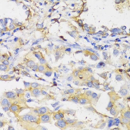 Polyclonal Rabbit anti-Human HLA-DPB1 Antibody (IHC)