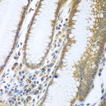 FUT6 Antibody