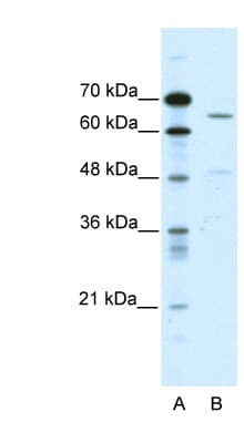 Polyclonal Rabbit anti-Human ACCN1 / ASIC2 Antibody (aa481-530, IHC, WB)