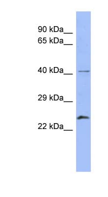 RAB5B Antibody (N-Terminus)