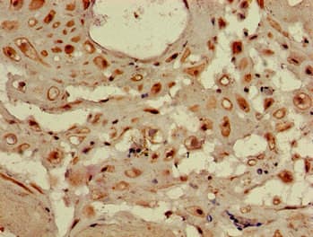 WDR19 Antibody