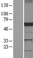 DCTN4 / Dynactin 4 Protein (Over-Expression Lysate Myc-DDK (Flag))