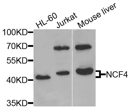 P40PHOX / NCF4 Antibody