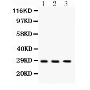 DKK2 Antibody (aa34-259)