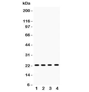 RBP4 Antibody (aa19-201)