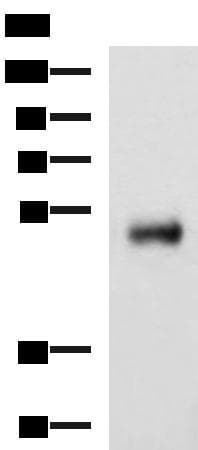 METT11D1 Antibody