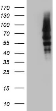 Monoclonal Mouse anti-Human CAPN5 / Calpain 5 Antibody (clone OTI1F10, aa274-578, WB)