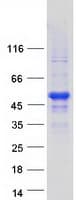 Human NAA30 Protein (Recombinant Myc-DDK (Flag))
