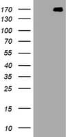 Monoclonal Mouse anti-Human NEFH / NF-H Antibody (clone OTI6F11, aa778-1020, IHC, WB)
