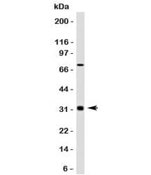 BCL10 / BCL-10 Antibody (clone MUBC10)