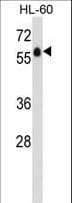 ADGRG3 / GPR97 Antibody (aa103-130)