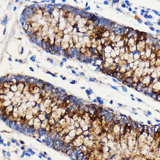 NOTCH1 Antibody