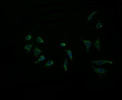 ACAA2 Antibody (clone OTI1B1)