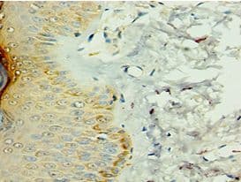 IL36RN / IL1F5 Antibody (aa1-155)