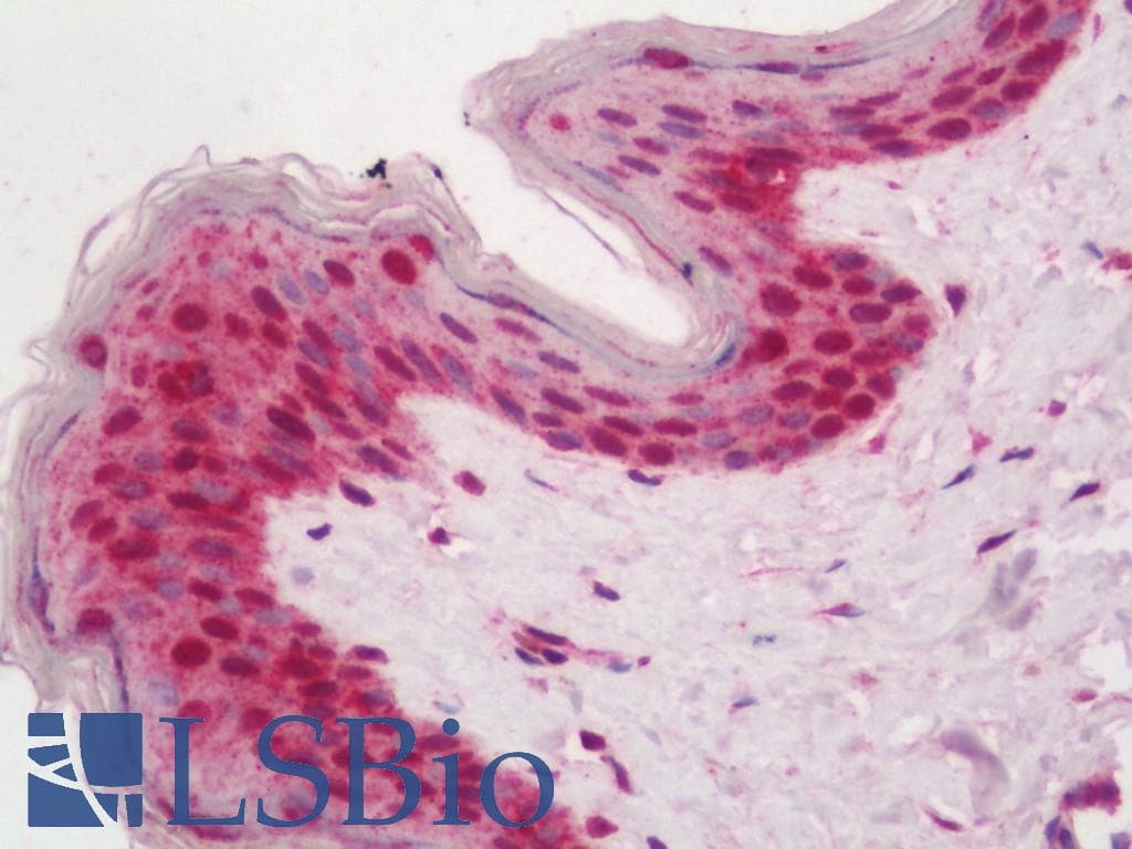 IHC-plus™ TICRR Antibody