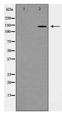 PDGFRA / PDGFR Alpha Antibody