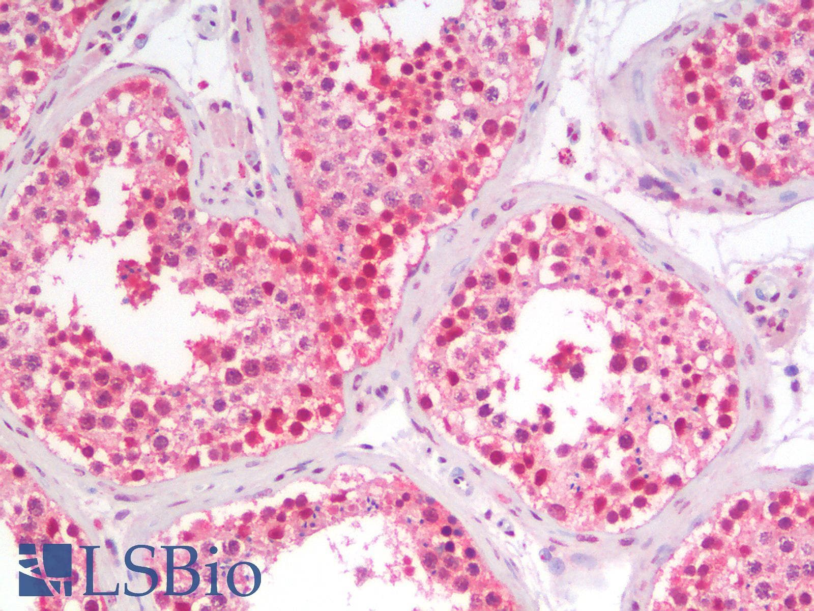IHC-plus™ Polyclonal Rabbit anti-Mouse FOS / c-FOS Antibody (IHC)