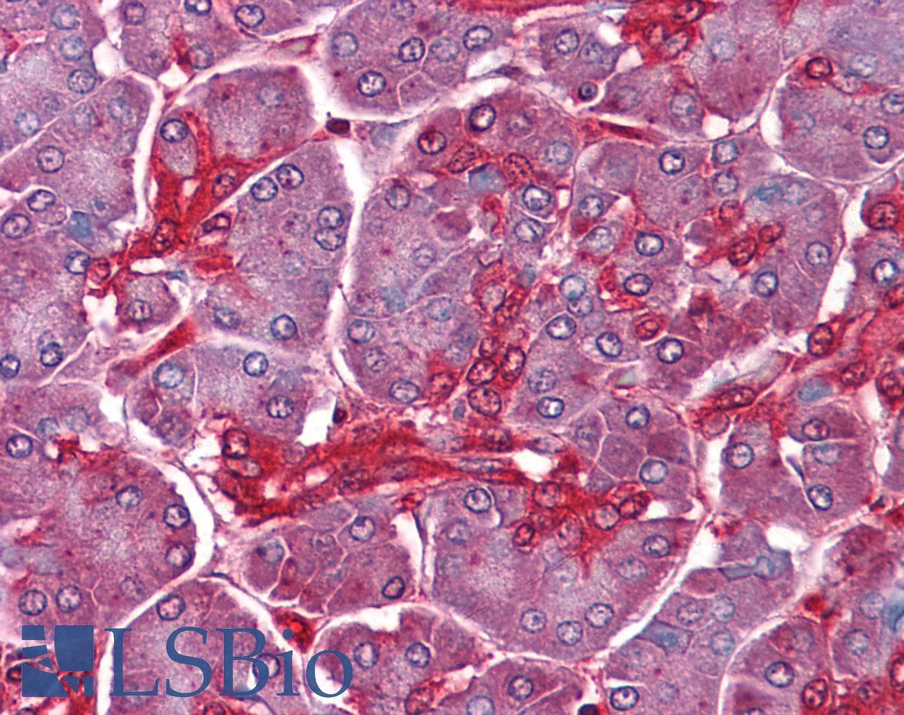IHC-plus™ CLIC1 / NCC27 Antibody (clone 2D4)