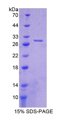 Mouse CRYBA1 Protein (Recombinant His-T7)