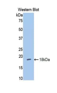 HK1 / Hexokinase 1 Antibody (aa676-800)