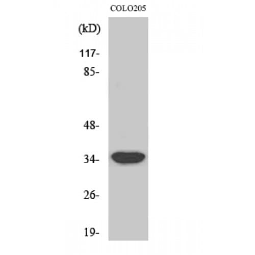 MRPL4 / MRP-L4 Antibody (60-140 aa, Internal)