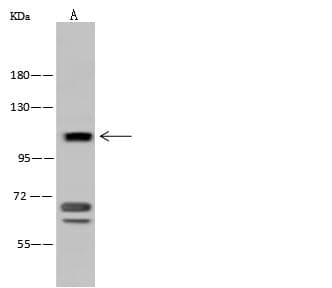Polyclonal Rabbit anti-Human ADAM17 / TACE Antibody (IF, WB)