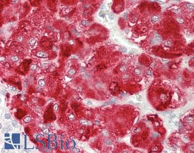 IHC-plus™ UBAP2L Antibody
