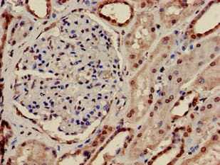 Polyclonal Rabbit anti-Human PRPS2 Antibody (IHC, IF, WB)