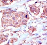 EPHB6 / EPH Receptor B6 Antibody (aa990-1021)