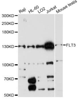 Polyclonal Rabbit anti-Human CD135 / FLT3 Antibody (IHC, WB)