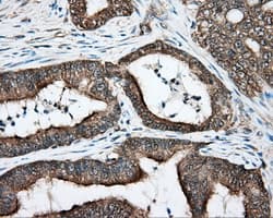 Monoclonal Mouse anti-Human DNTTIP1 / TDIF1 Antibody (clone OTI1F4, IHC, IF, WB)