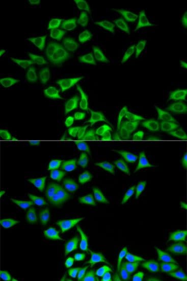 CHMP2B Antibody