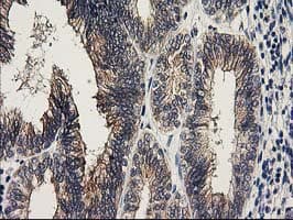 KCTD14 Antibody (clone OTI2B9)