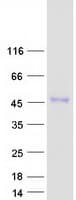 Human ENTPD5 / CD39L4 Protein (Recombinant Myc-DDK (Flag))