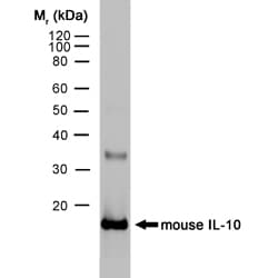 PathPlus™ IL-10 Antibody (clone JES5-2A5)
