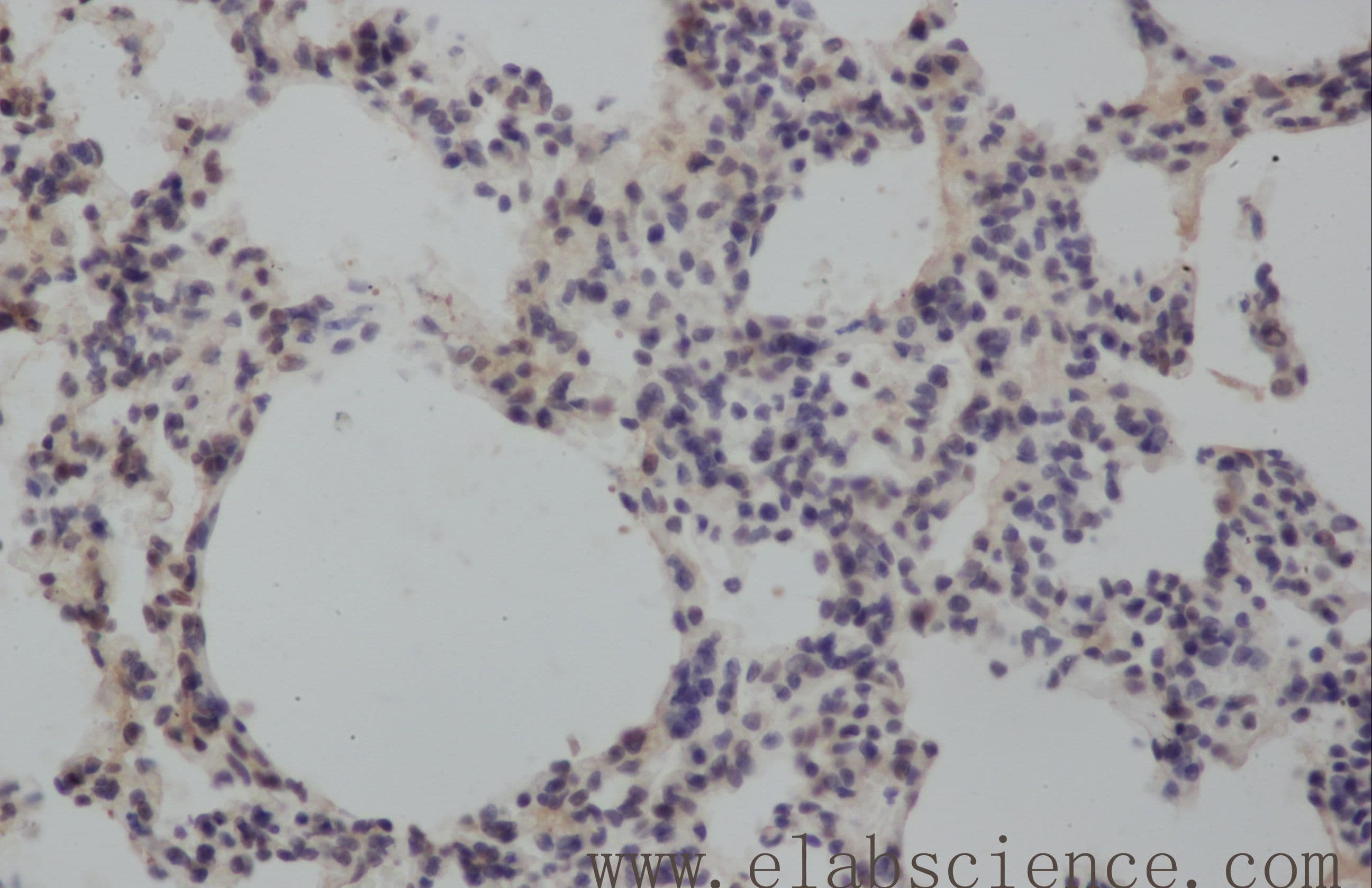 Polyclonal Rabbit anti-Human MMP8 Antibody (IHC, WB)