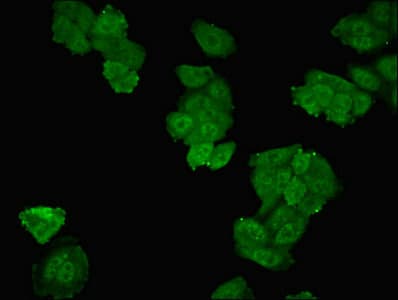 Polyclonal Rabbit anti-Human SMPX Antibody (IHC, IF)