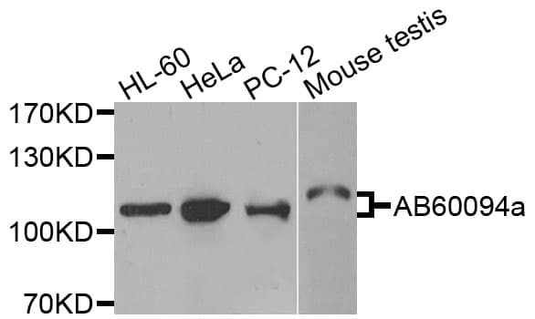 ADAMTS5 Antibody