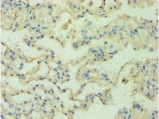 RRM2B / P53R2 Antibody (aa1-351)