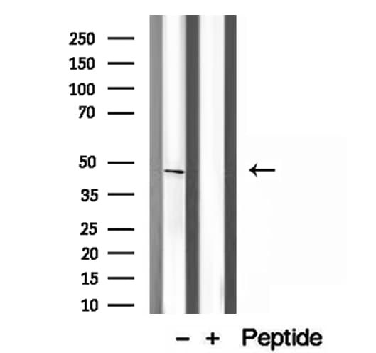 Polyclonal Rabbit anti-Human HLA-F Antibody (IHC, IF, WB)