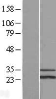 SCO1 Protein (Over-Expression Lysate Myc-DDK (Flag))