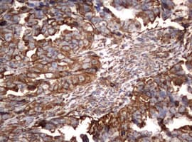 Vimentin Antibody (clone OTI1A9)