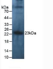 IL-10 Antibody (aa19-178)